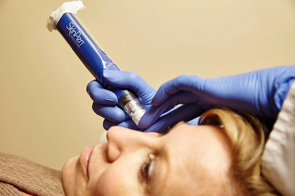 Skinpen im Einsatz