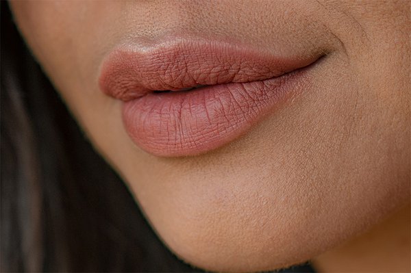 Augmentation mit Hyaluron