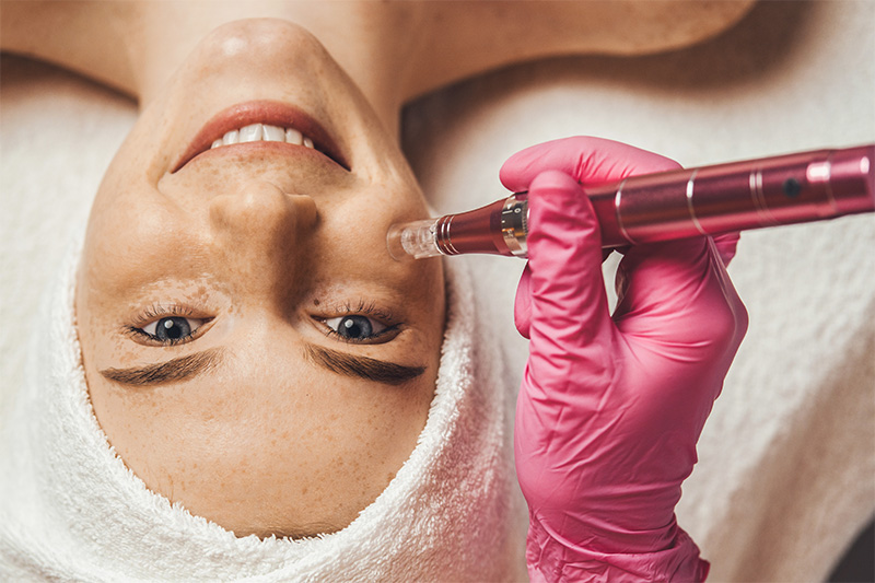 Microneedling und Mesotherapie